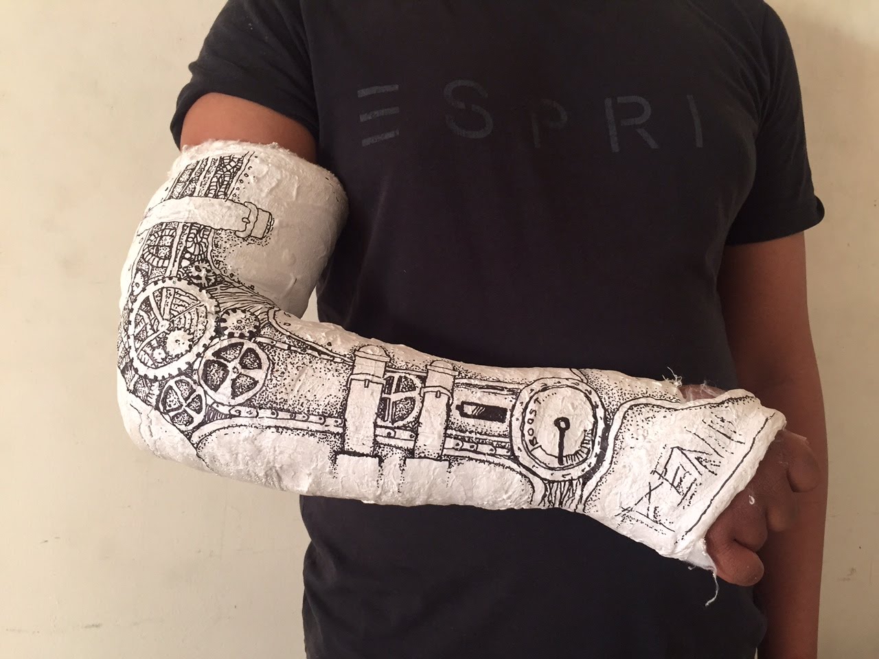 Broken Arm Cast Drawing at GetDrawings Free download