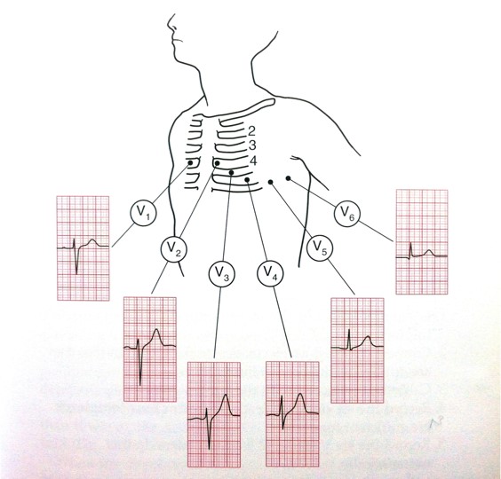 ekg-drawing-at-getdrawings-free-download