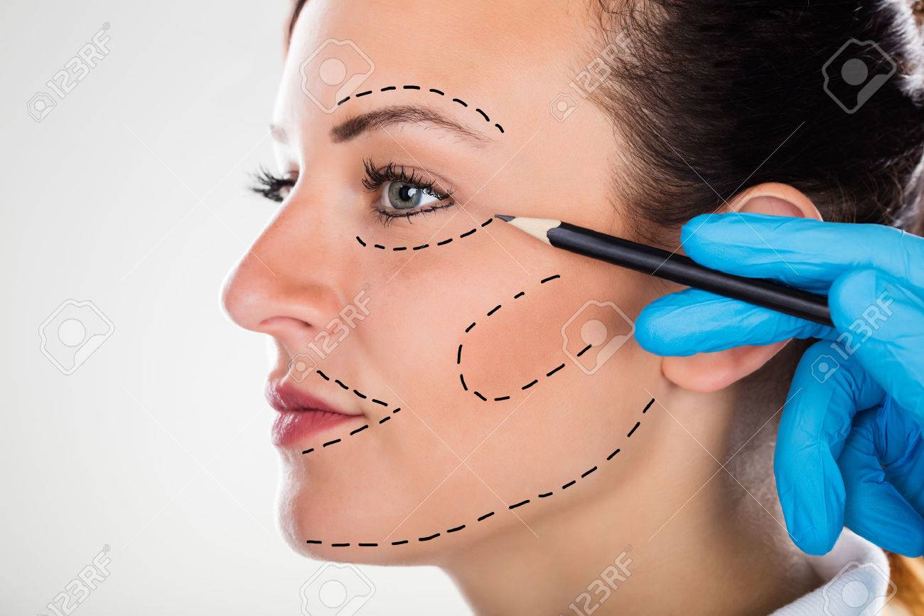 Plastic Surgery Drawing at GetDrawings Free download
