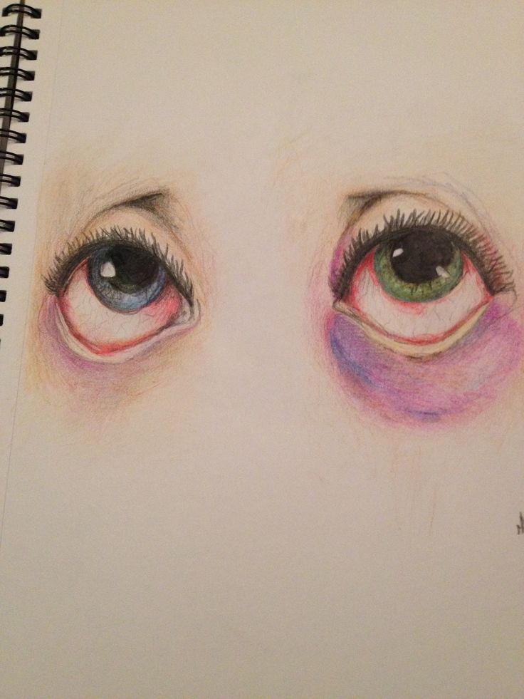 Tired Eyes Drawing at GetDrawings | Free download