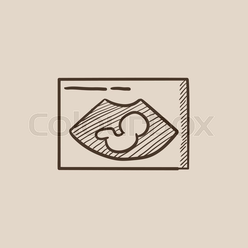 Ultrasound Drawing at GetDrawings Free download