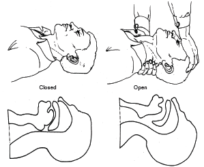 Head Tilted Back Drawing at GetDrawings | Free download