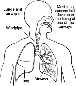 Lung Cancer Drawing at GetDrawings | Free download