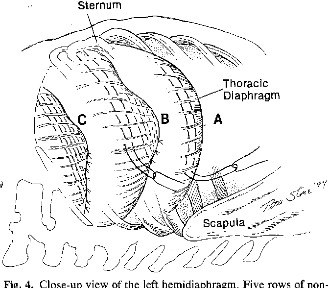 Diaphragm Drawing At Getdrawings 