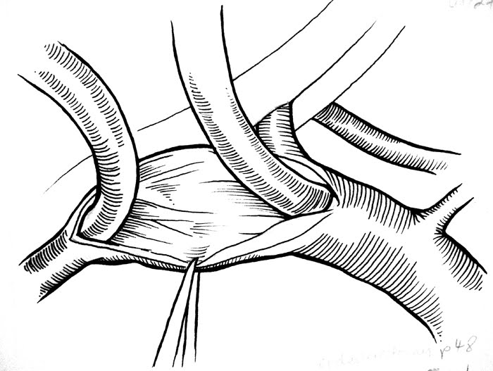 Muscle Tissue Drawing at GetDrawings | Free download