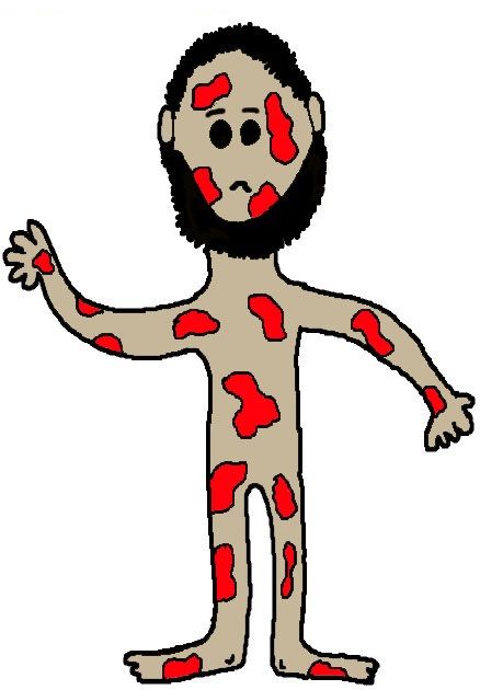 438x630 Boils Cliparts Free Download Clip Art