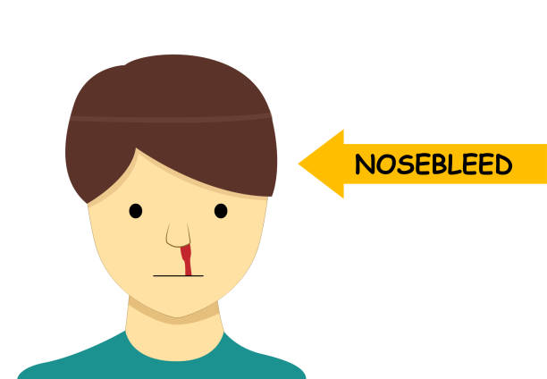 612x424 Nose Bleeding Clipart