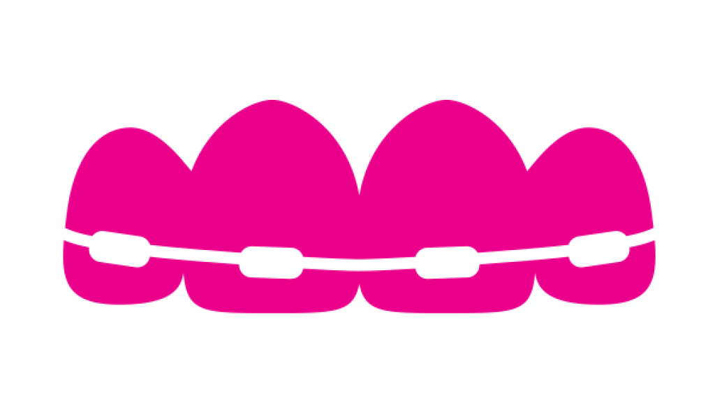 1024x600 Everything You Need To Know About Dental Braces Dencover