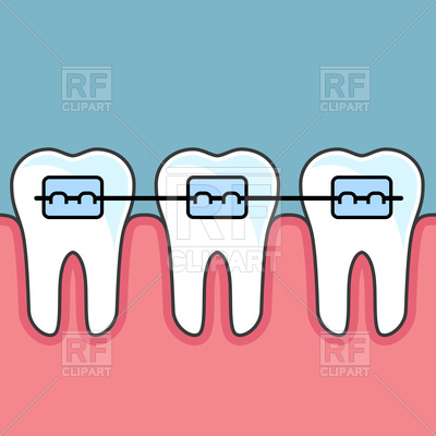 400x400 Teeth With Dental Braces