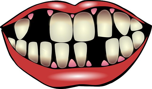 640x374 Tooth Gap Clipart Amp Tooth Gap Clip Art Images