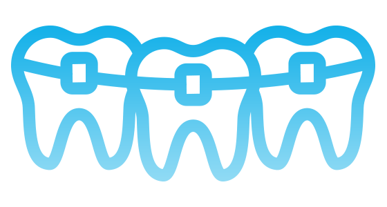 560x300 Atelier Ortho Braces