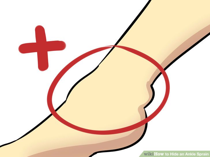 728x546 Ankle Clipart 6 Clipart Station