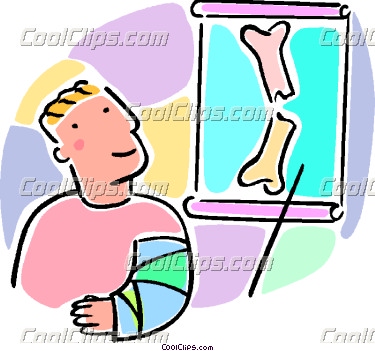 375x351 X Ray Clipart Bone