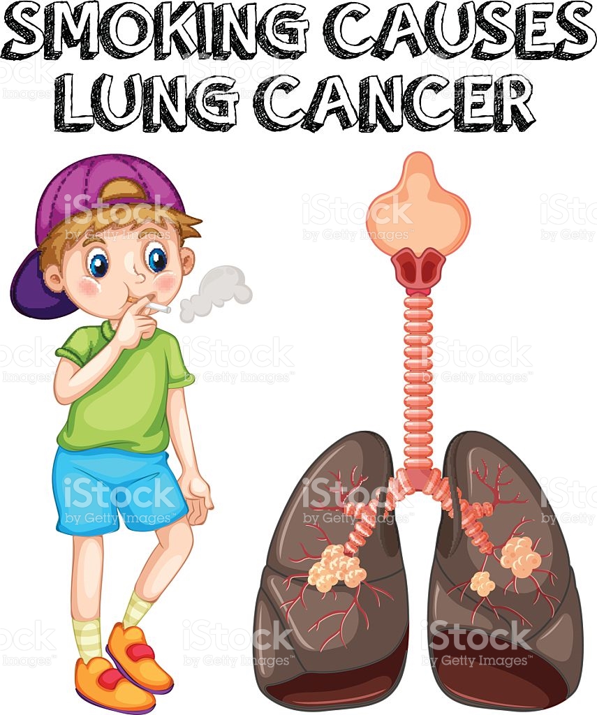 855x1024 Cigarette Clipart Lung