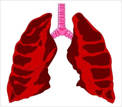 401x351 Lungs Amp Trachea Clip Art Human Body Clip Art Clip Art