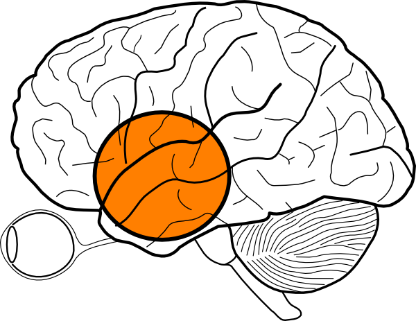 600x463 Frontal Lobe Mass Clip Art