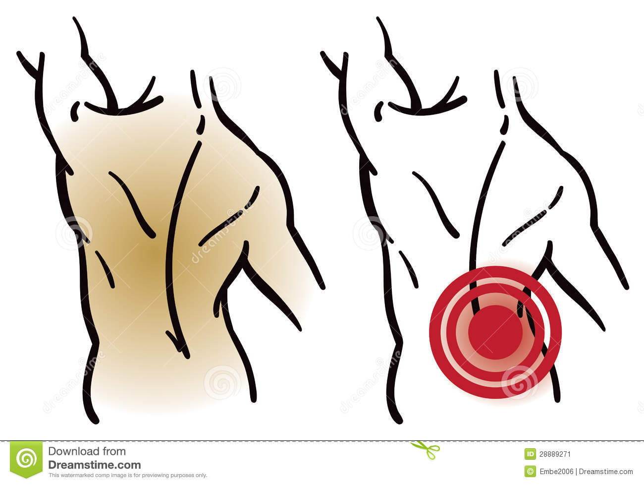 1300x978 Clip Art Muscle Clip Art