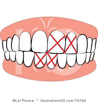 400x420 Sorry Logo Clip Art