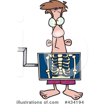 400x420 Xray Clipart
