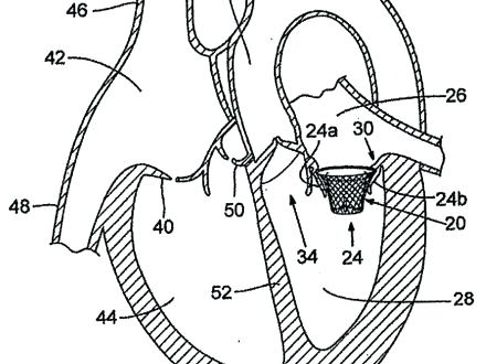 440x330 Circulatory System Coloring Page Circulatory System Coloring