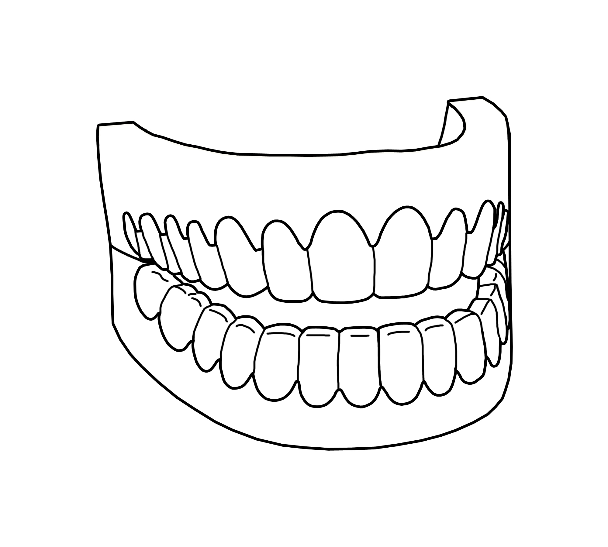 2000x1800 Dentist And Kid Dental Braces Coloring Pages Page Teeth Educations