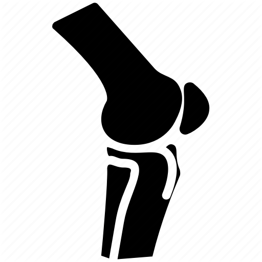 Bone Fracture, Broken Bone, Joint Fracture, Knee Fracture, Knee