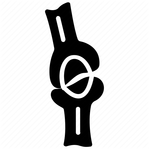 Bone Injury, Bone Trauma, Broken Joint, Broken Knee, Displaced