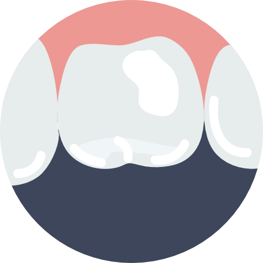 Professional Teeth Whitening