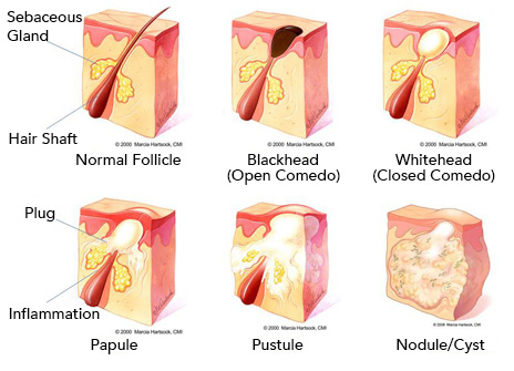 464x335 Clear By Nature