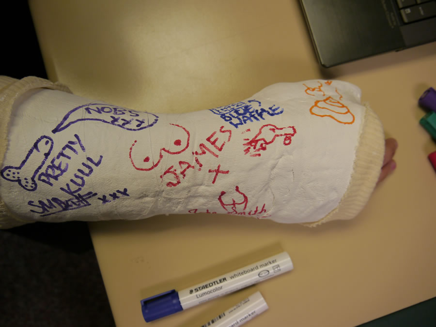 900x676 Carmageddon 10k Backer Ken's Arm Cast!