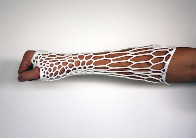660x467 Is This 3 D Printed Cast The Future Of Healing Broken Bones Wired