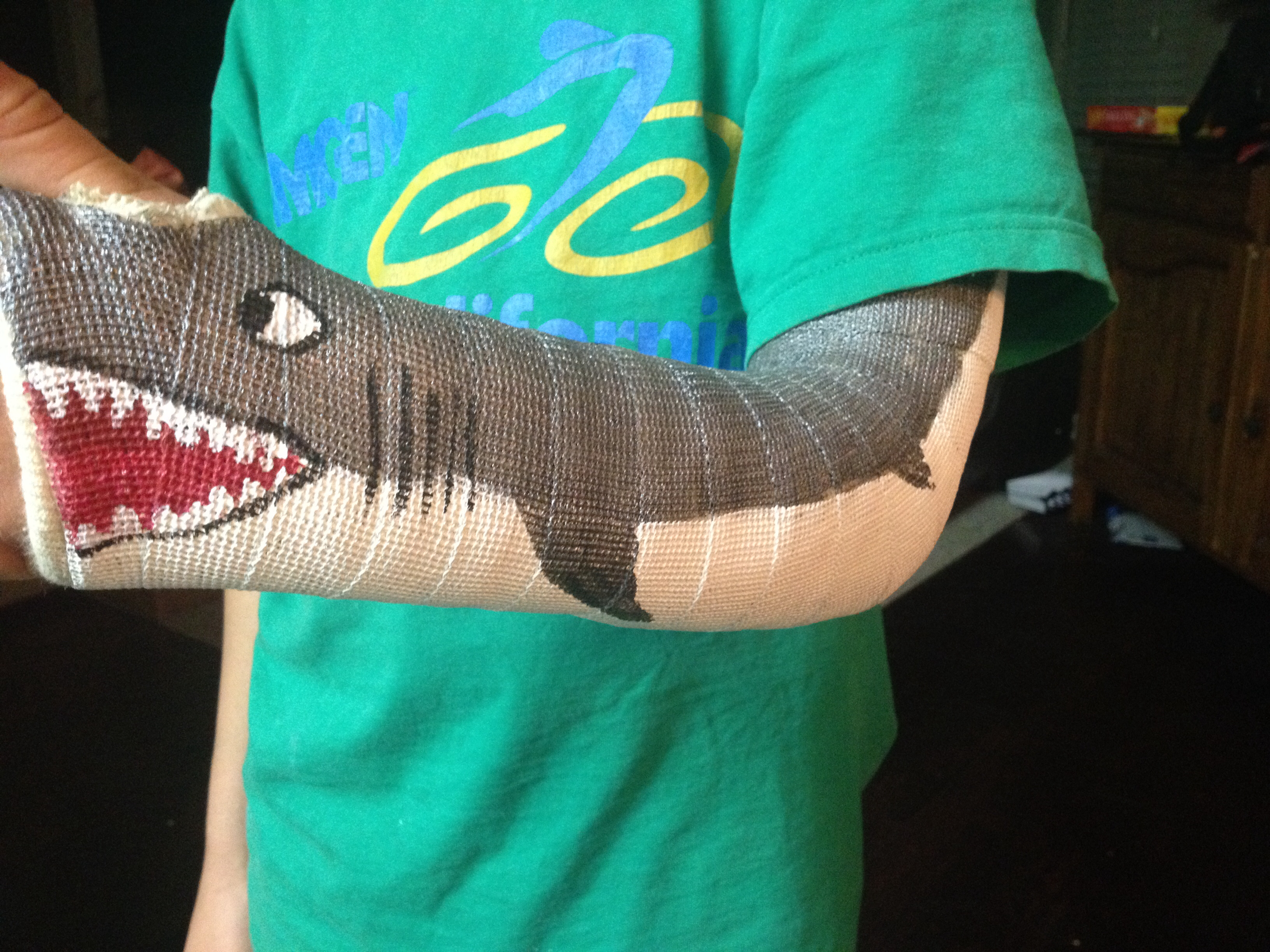 3264x2448 Painting Great White Shark On My Son's Cast, One Way To Make