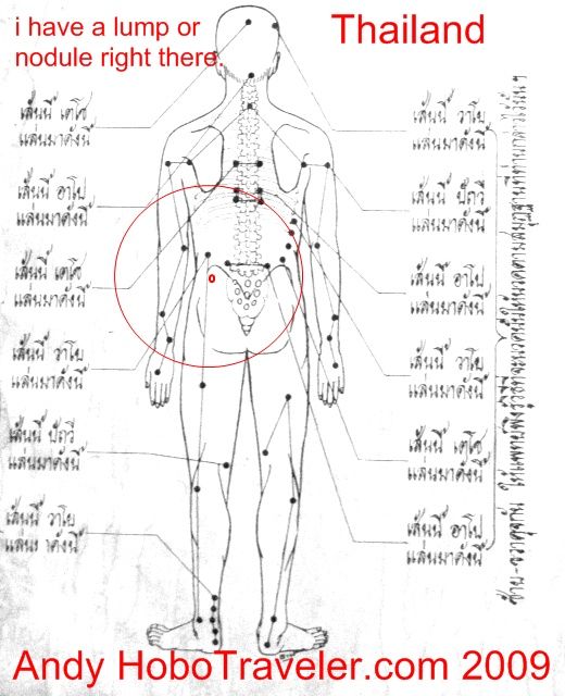 520x640 Back Pain Relief In Thailand