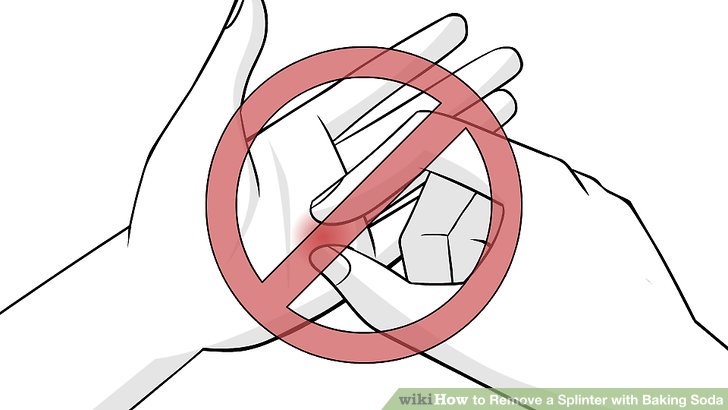 728x410 How To Remove A Splinter With Baking Soda 10 Steps