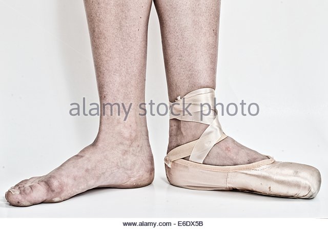 640x447 Calluses Feet Stock Photos Amp Calluses Feet Stock Images