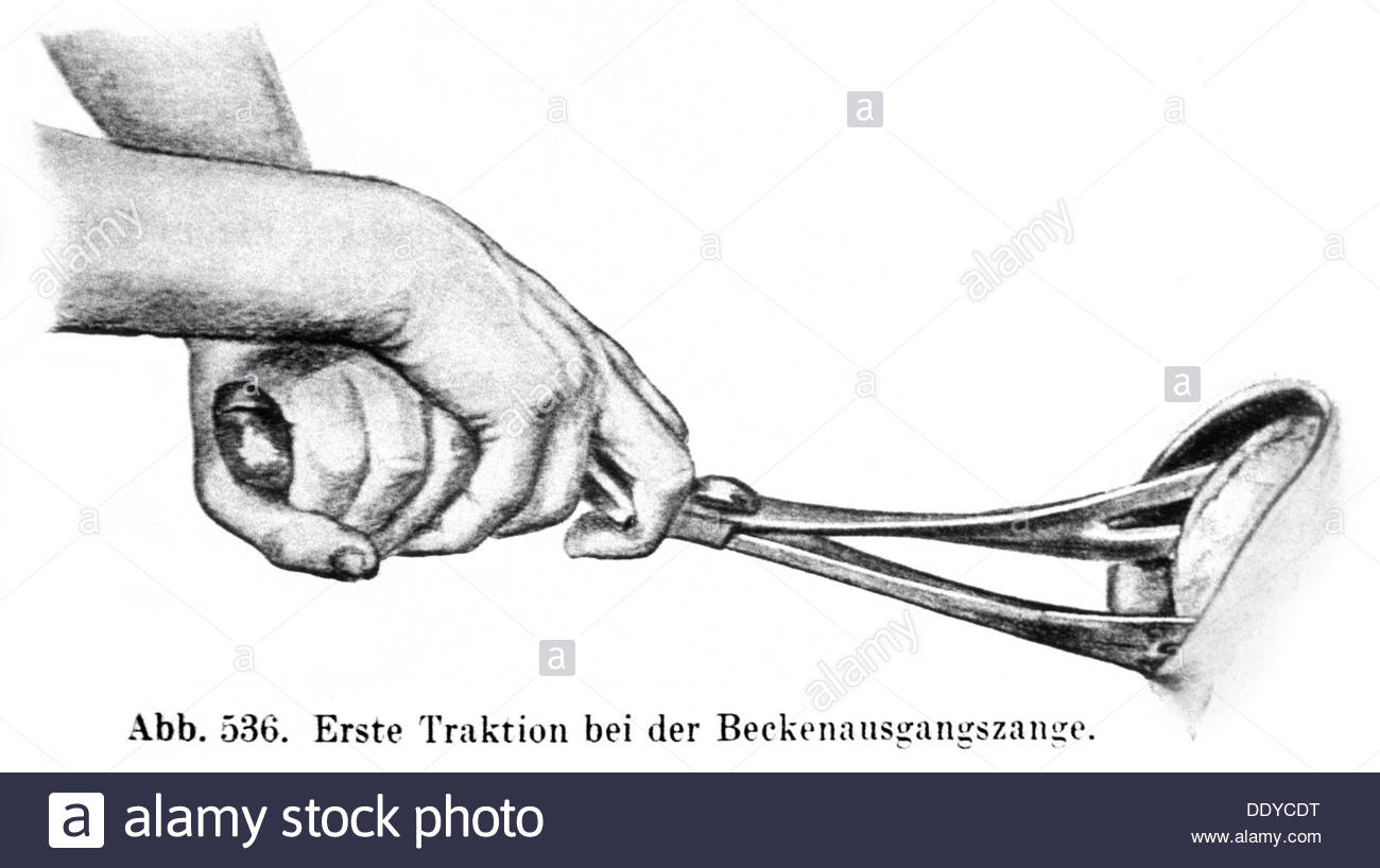 1300x818 Medicine Birth Gynecology Application Of A Forceps Drawing 20th
