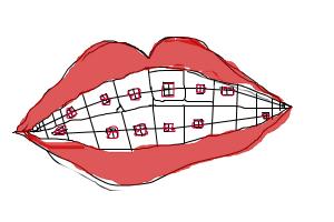 300x200 How To Draw Braces