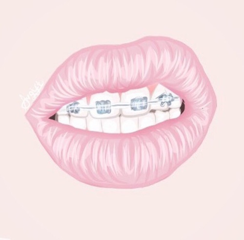 500x493 Smile With Braces Drawing