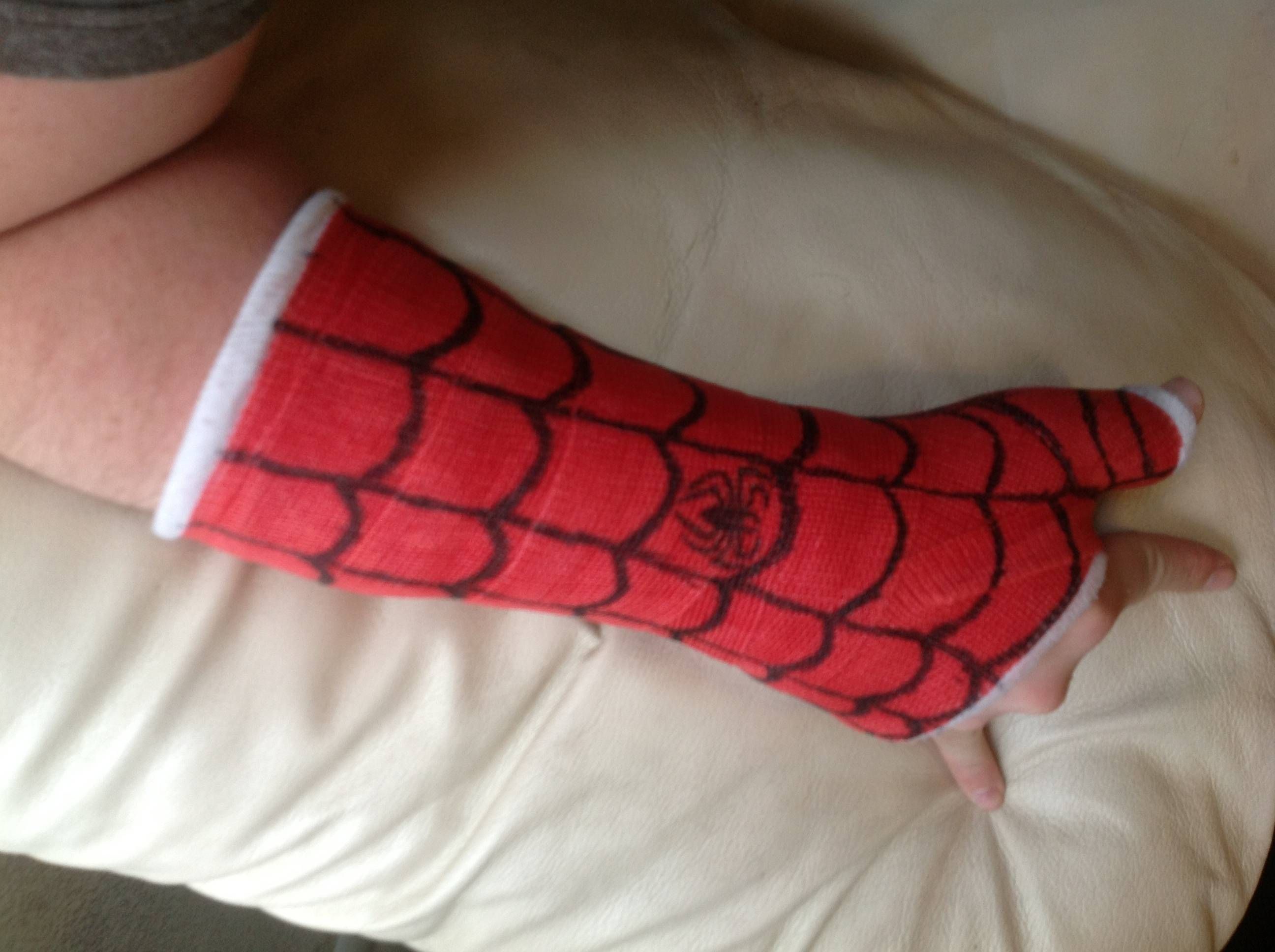 2592x1936 Cast Tip We Offer A Variety Of Colors For Your Arm Or Leg Cast