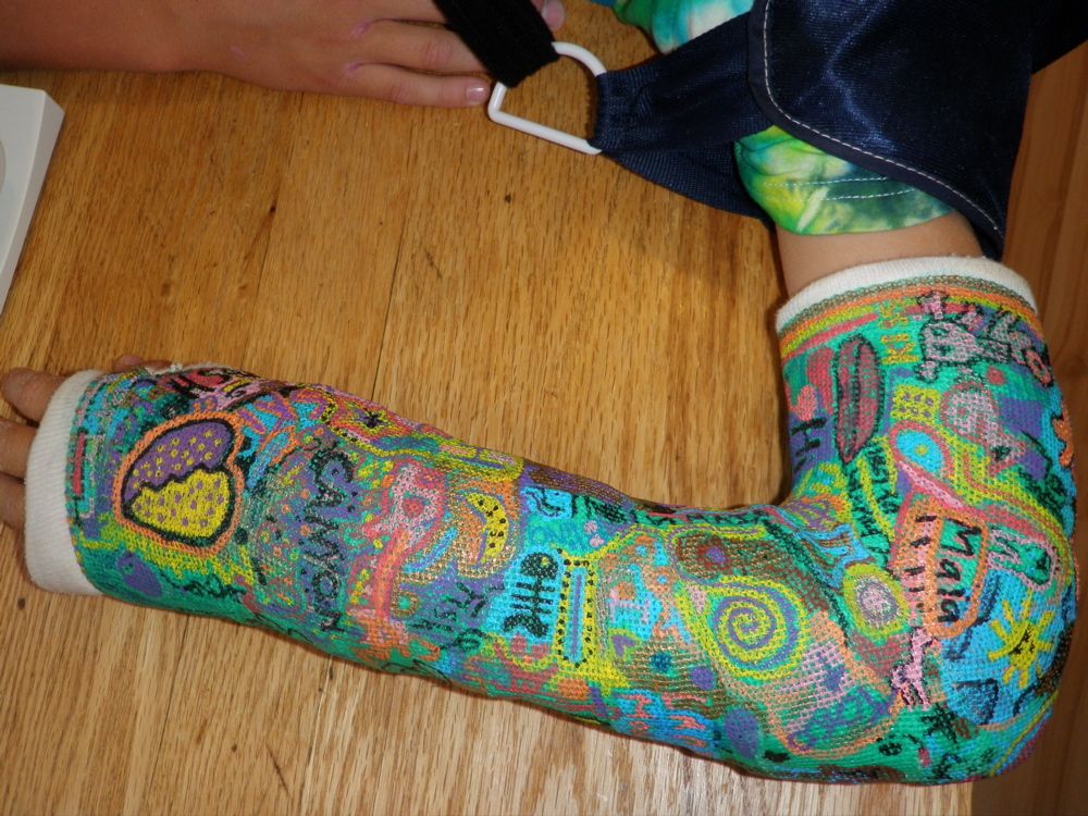 1000x750 Cast Art Noelleodesigns Thing I Want To Do Arm