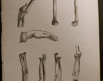 340x270 Vintage Broken Bones Etsy