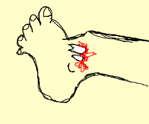 300x250 Broken Ankle