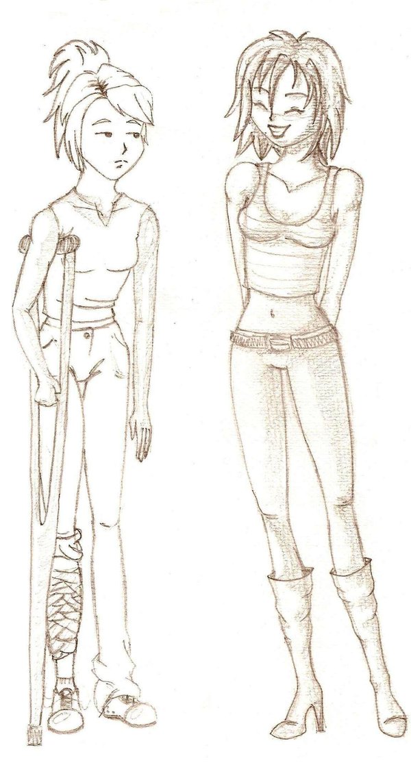 600x1114 Funny Looking Broken Leg By Denatart