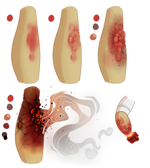 500x558 How To Draw Burns