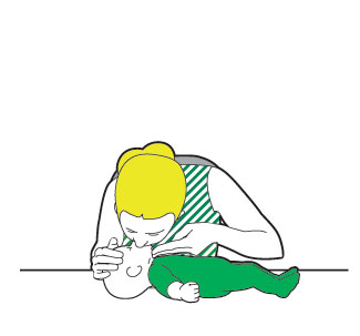 Cpr Drawing at GetDrawings | Free download