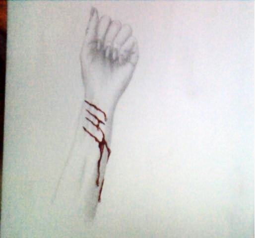 514x480 Bleeding Arm By Marilynmansondk