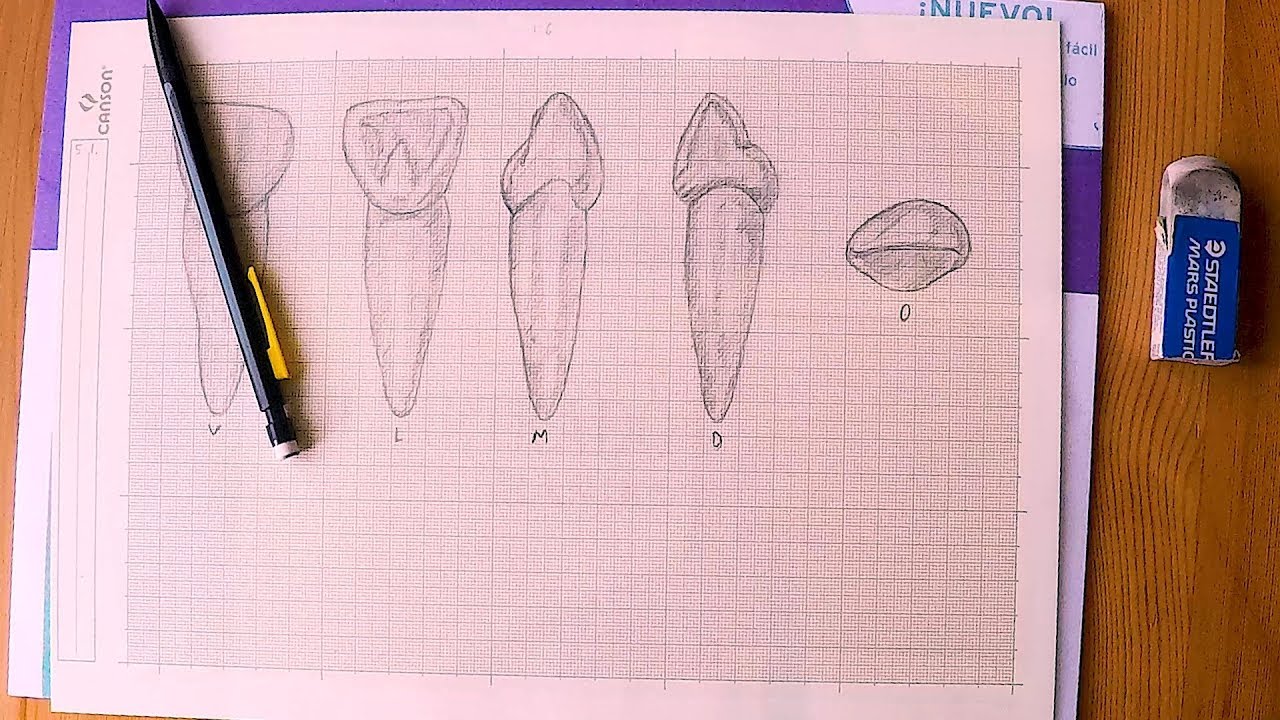 1280x720 Fdi 5.1. Haderup A . Anatomical Dental Drawing. Dibujo