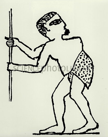 417x530 Pott's Disease In Egyptian Tomb Drawing