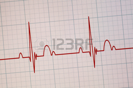 450x300 Runner Shaped Blip On A Medical Heart Monitor (Ecg