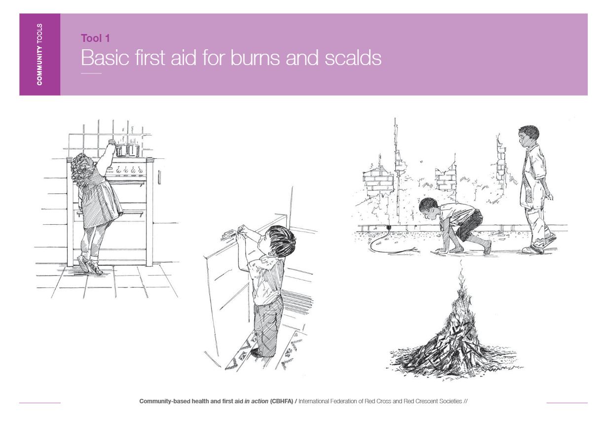 1230x858 Community Tools Tool 1 Basic First Aid For Burns And Scalds
